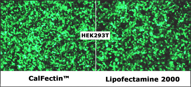 CalFectin_vs_Lipo2000_HEK293