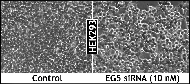 LipoJet_EG5_HEK293